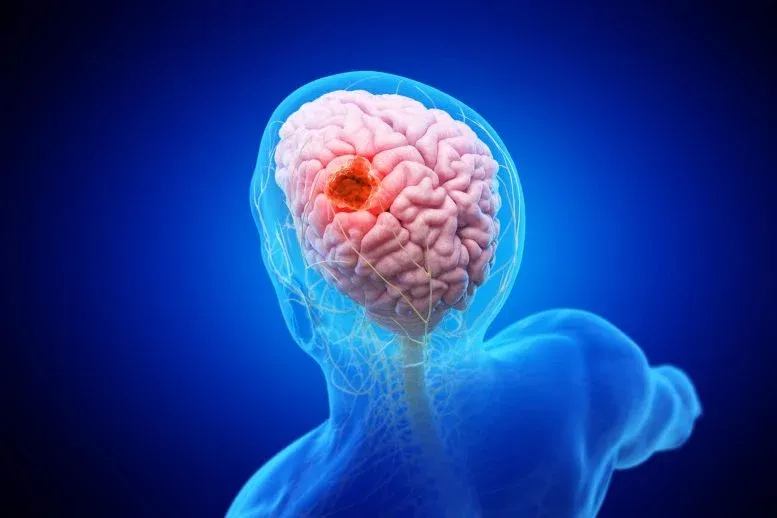 A 'Double Punch' Nanoparticle Could Reveal and Destroy Brain Cancer