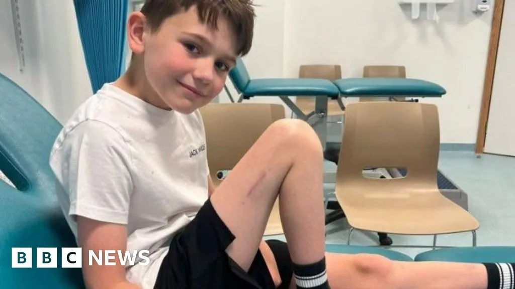 Boy first in UK to have pioneering leg-lengthening surgery