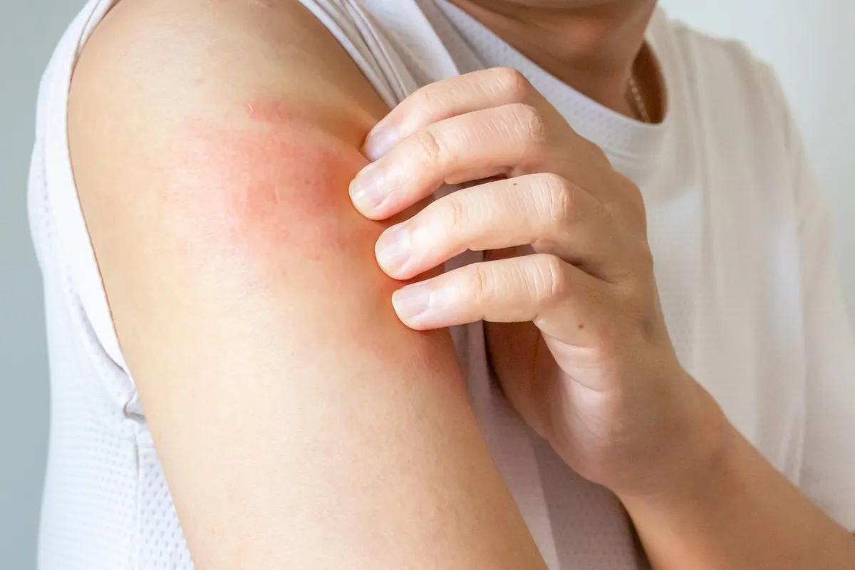 Scientists Discover Why We Know When To Stop Scratching an Itch