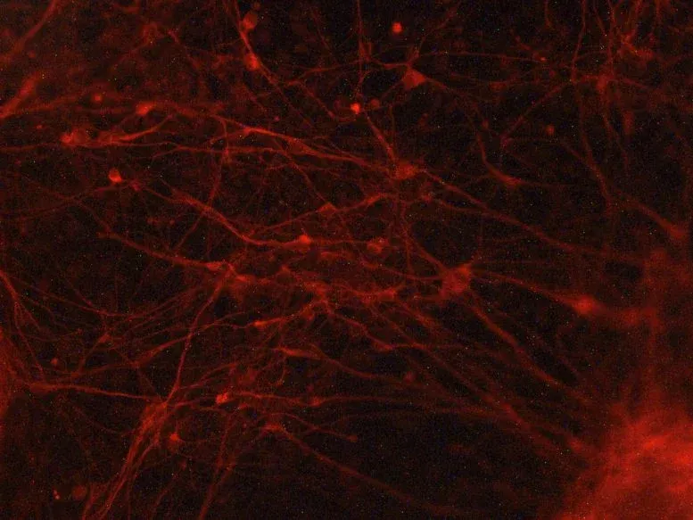 Human iPSC Derived Neurons
