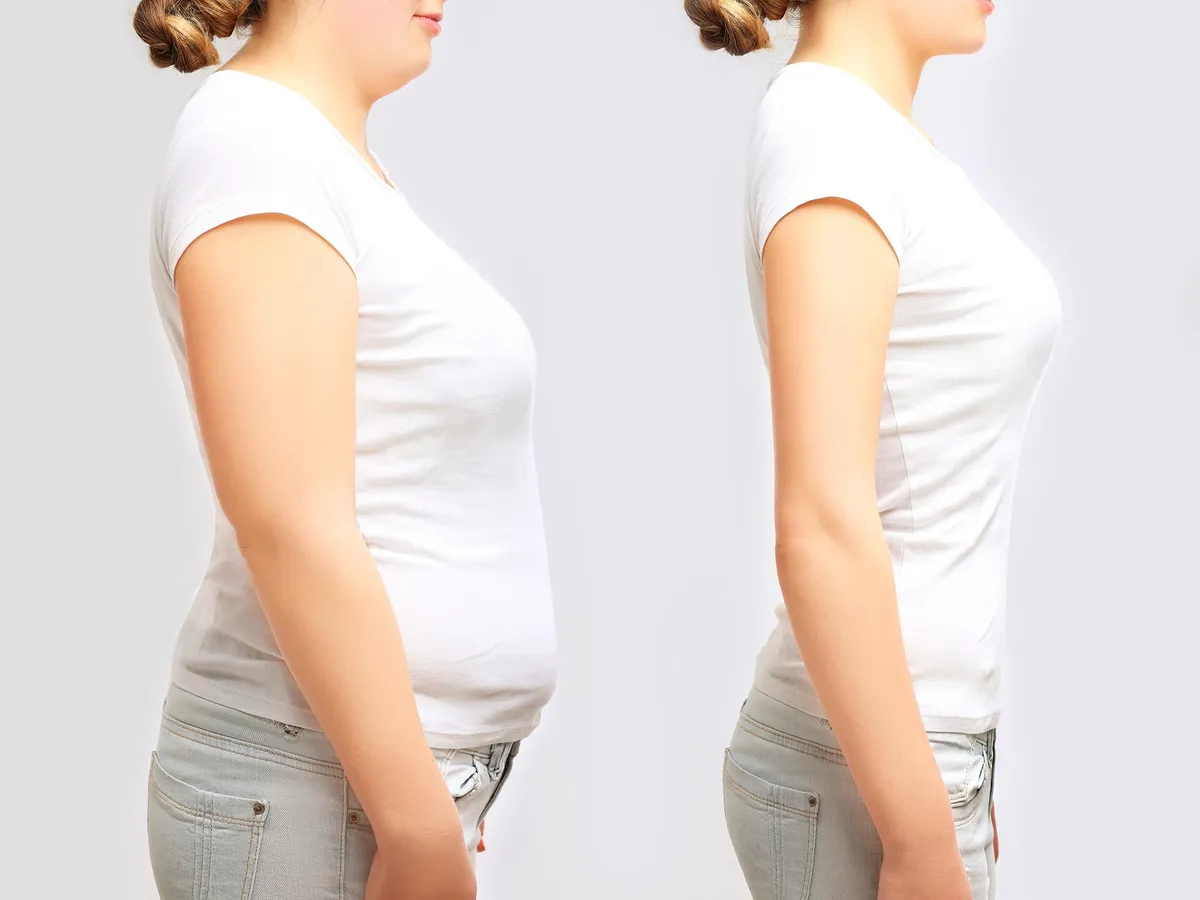 Hormone Therapy May Supercharge Popular Weight-Loss Drugs After Menopause