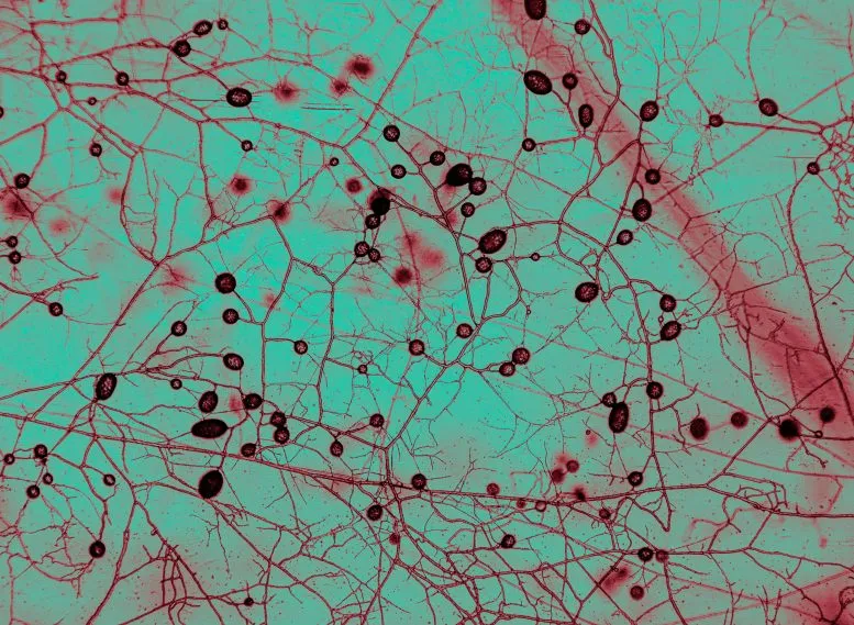 Mycorrhizal Fungi Under Microscope