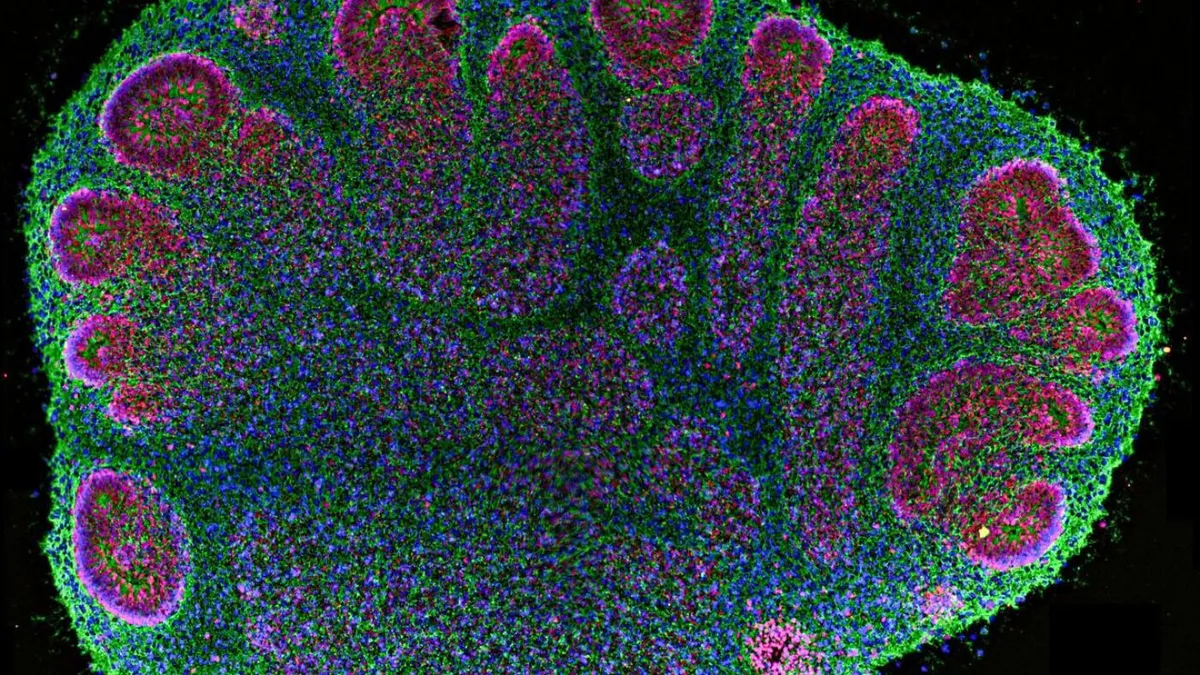 Cerebral Organoids Unlock Unprecedented Insights, Sparking Ethical Debate