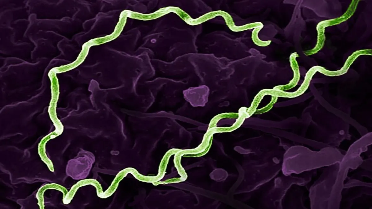 5,550-year-old Colombian man carries world’s oldest syphilis-related bacteria, study finds