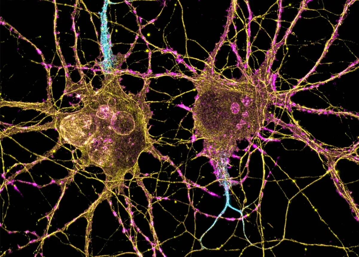 A New Drug Turns Brain Cells Into Neurons, Reversing Alzheimer's in Mice
