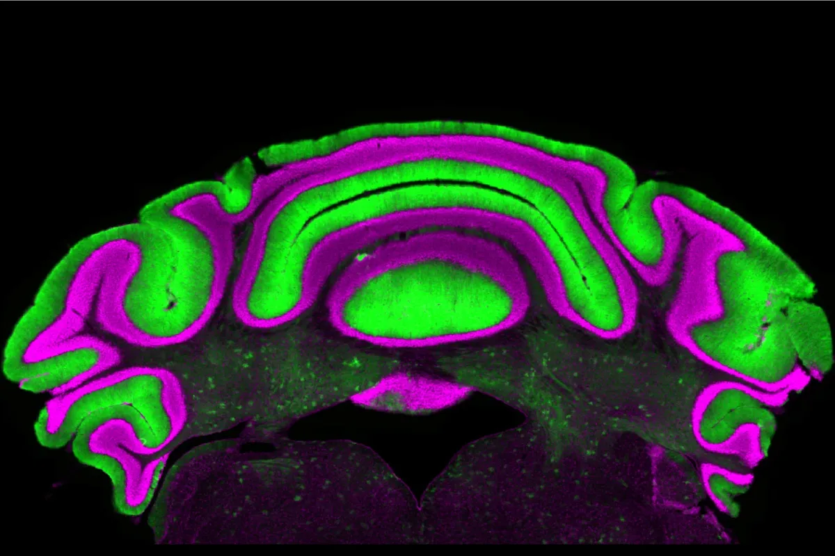Scientists Just Upended Decades of Brain Research on Movement Disorders