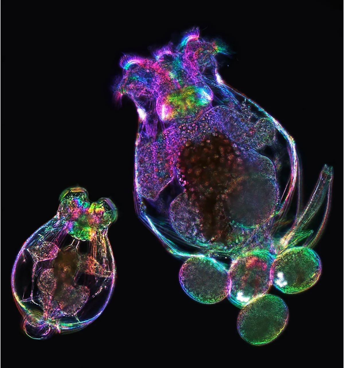 Molecular memory: How a mother's age echoes in her offspring's cells