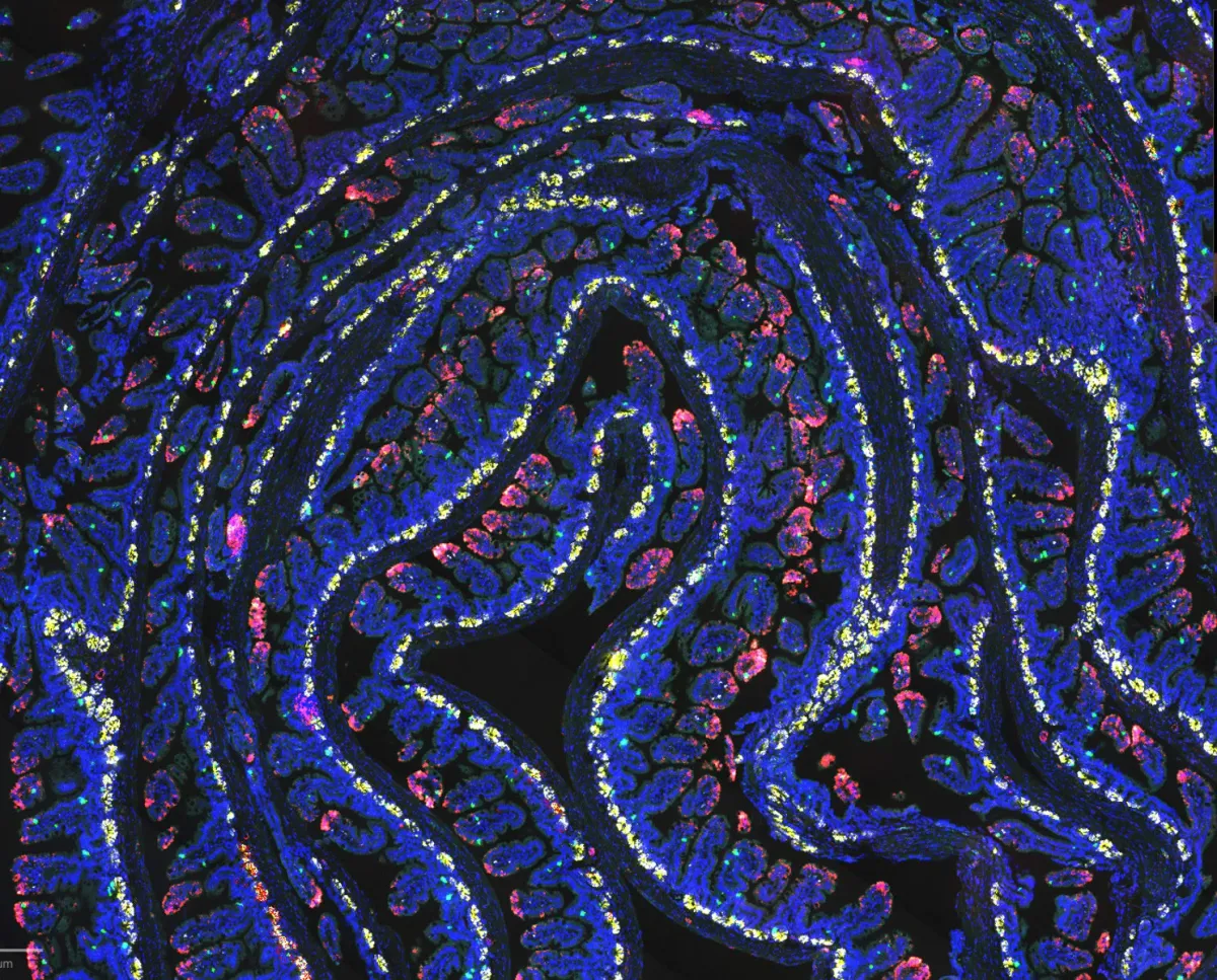 A 24-Hour Fast Activates a Microbial Pathway That Helps Heal the Gut