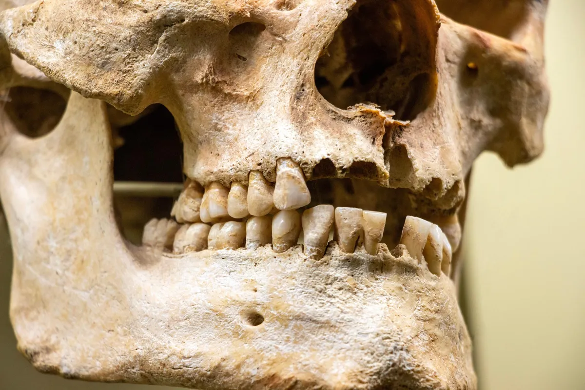 Scientists Say a 59,000-Year-Old Neanderthal Tooth Shows Evidence of Surgery