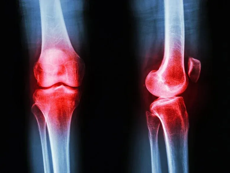 Researchers Discover Rheumatoid Arthritis Vulnerability May Begin Before Birth