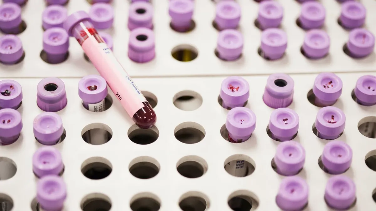 One blood test could reveal your hidden heart disease risk