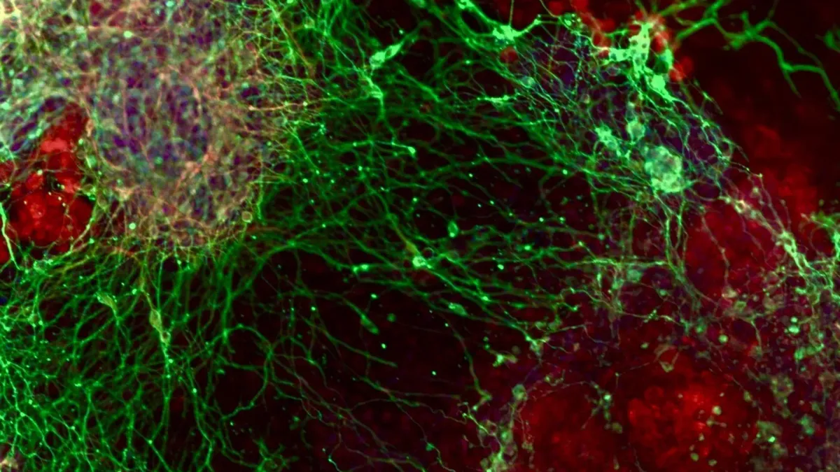 Genetic Hunt Reveals 331 Brain-Making Keys