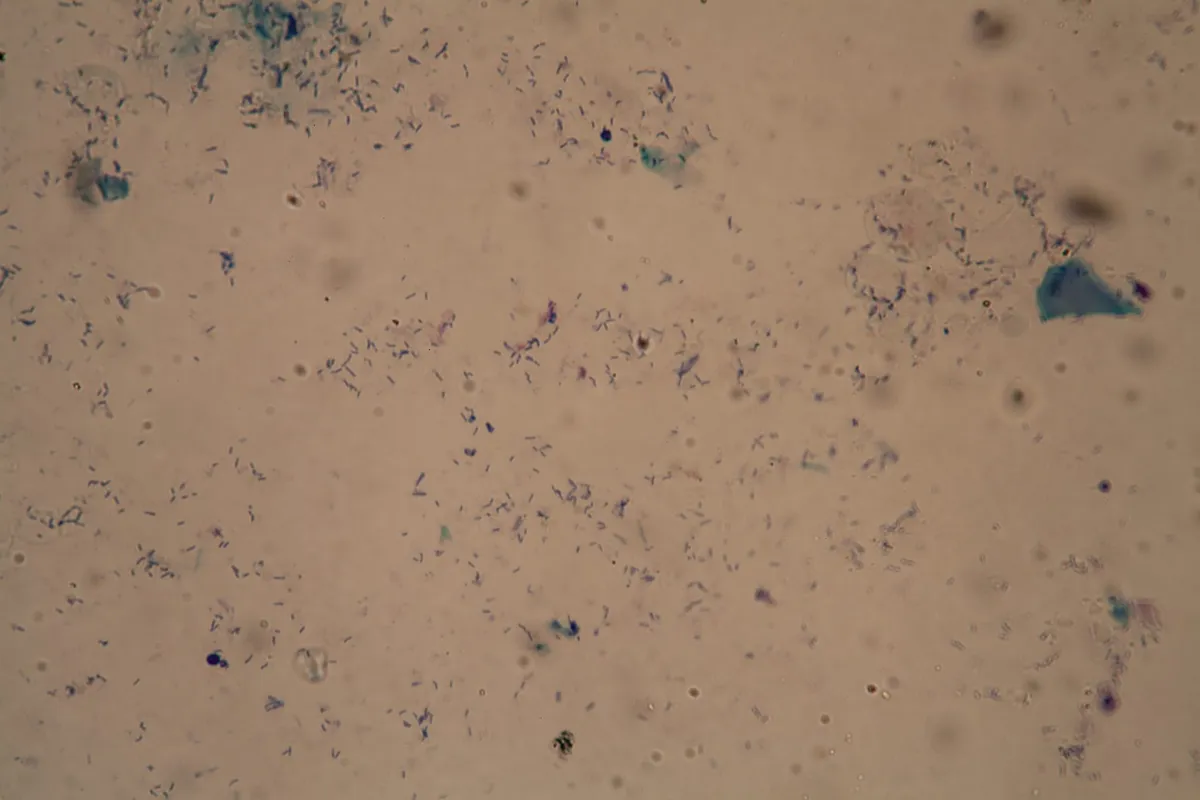 A Portable Device Just Outsmarted 150 Years of TB Testing