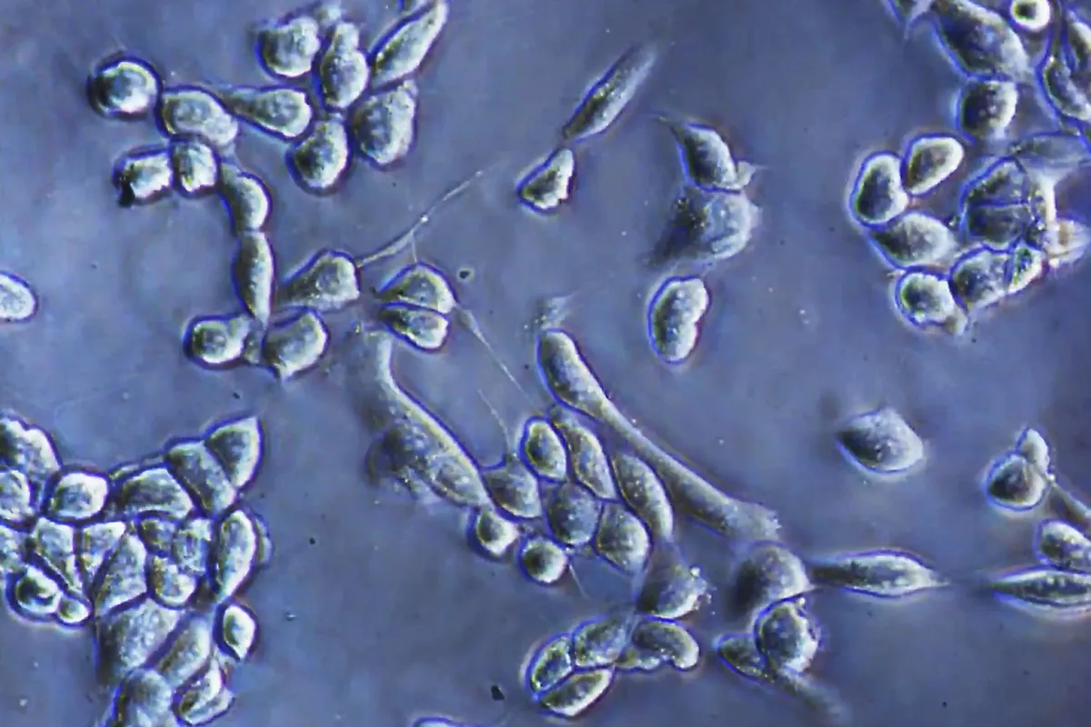 An improved way to detach cells from culture surfaces