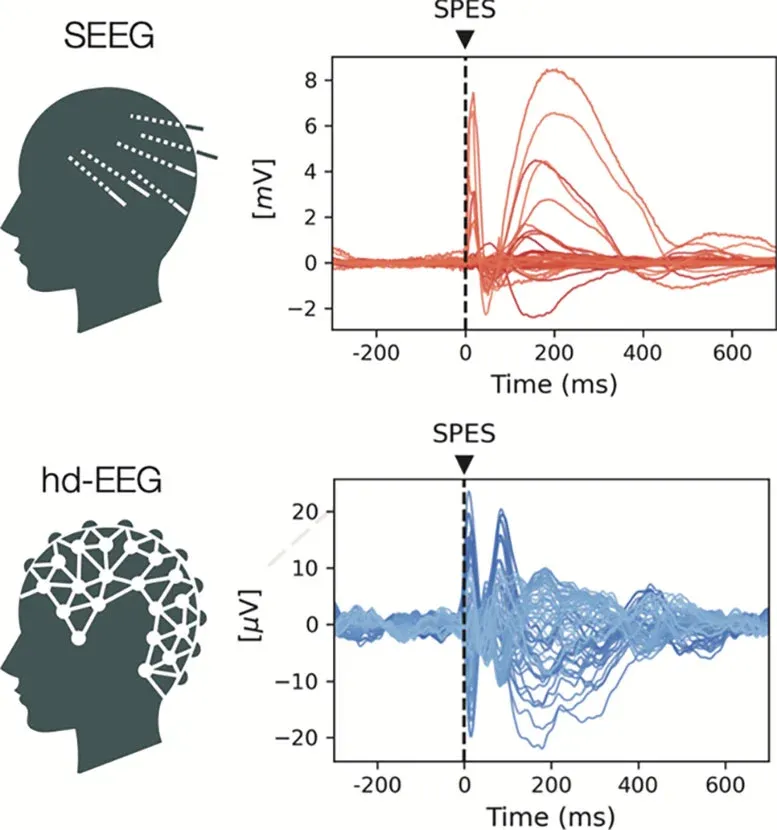 Your Brain's Mood Before Stimulation Could Unlock Better Treatments