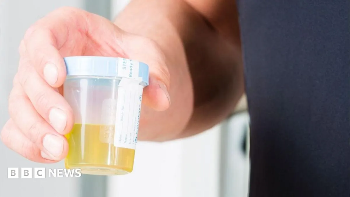 A New Pee Test Can Spot 92% of Bladder Cancers, No Camera Required