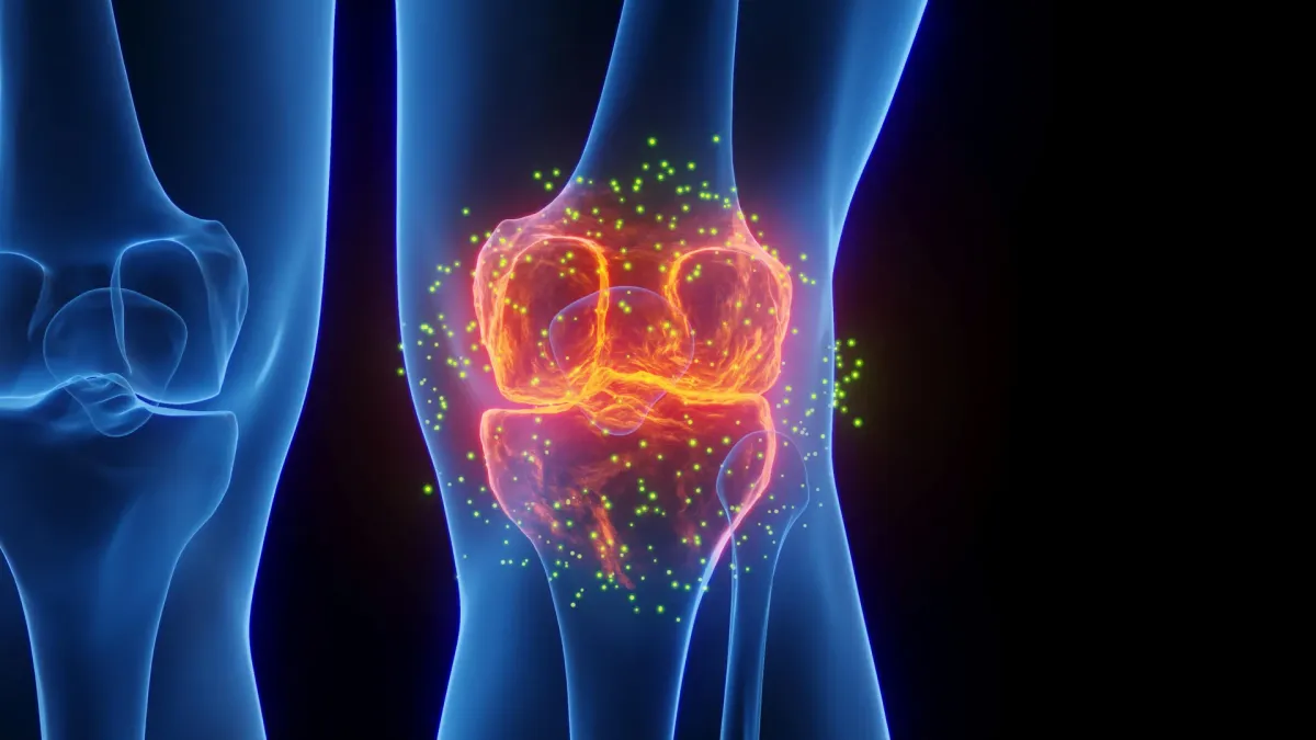 This emerging treatment is helping people avoid knee replacement surgery