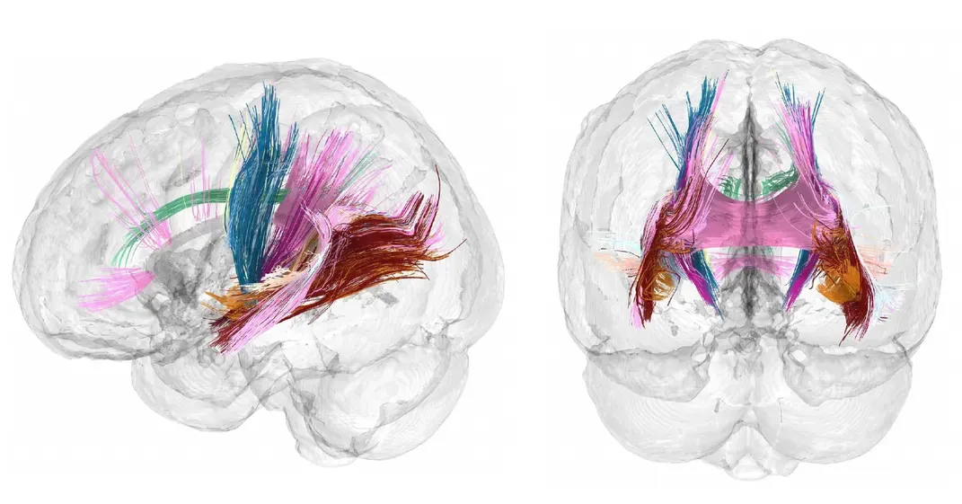 Pregnancy Changes Mothers’ Brains. These Recent Discoveries Are Showing Us How