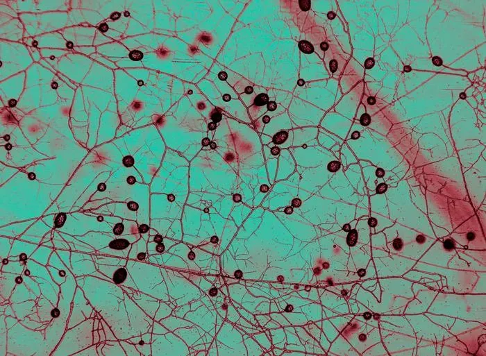 Nearly All Plants Depend on Tiny Underground Fungi. The Microbes' Vast Global Networks Were Just Mapped for the First Time
