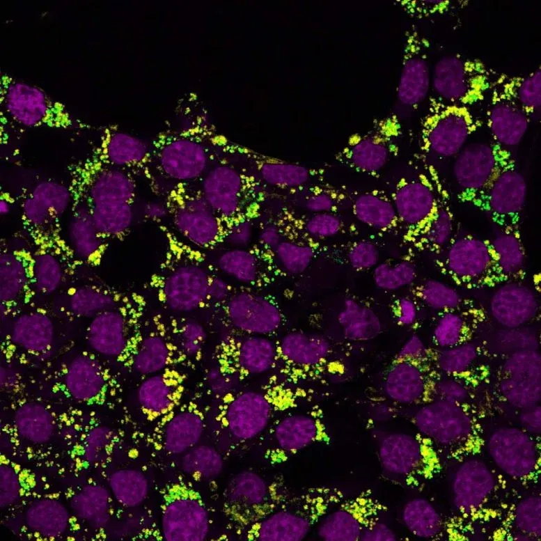 Viagra May Block a Hidden Pathway Cancer Cells Need To Spread