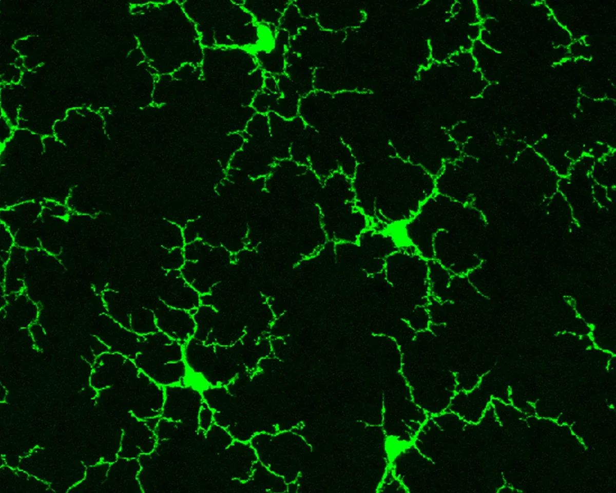 Microglia Rejuvenation Shatters Limits on Brain Repair