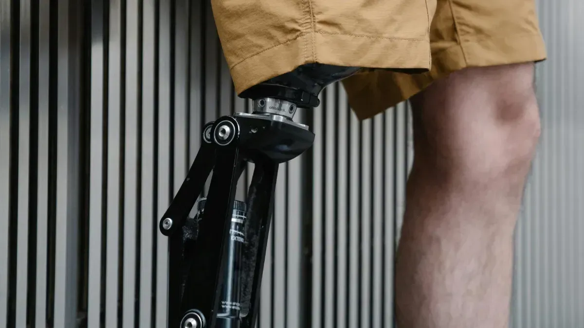 Amputees Become Shoe Trading Sole Mates After Years of Searching for a Match