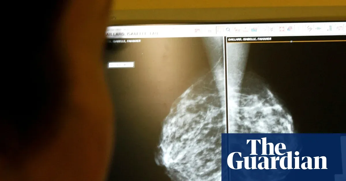 AI use in breast cancer screening cuts rate of later diagnosis by 12%, study finds