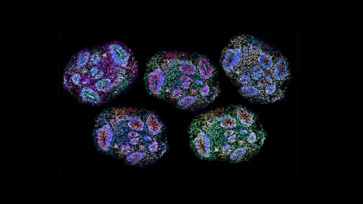 Lab-Grown Mini Brains Just Lived Five Years. They Have an Internal Clock.