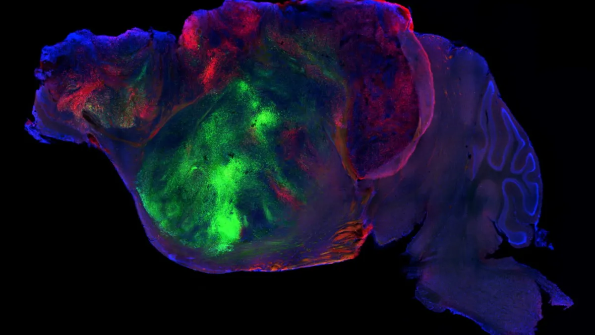 Mice With Human Brain Cells: A Disease Breakthrough, Or A Sci-Fi Movie Plot?