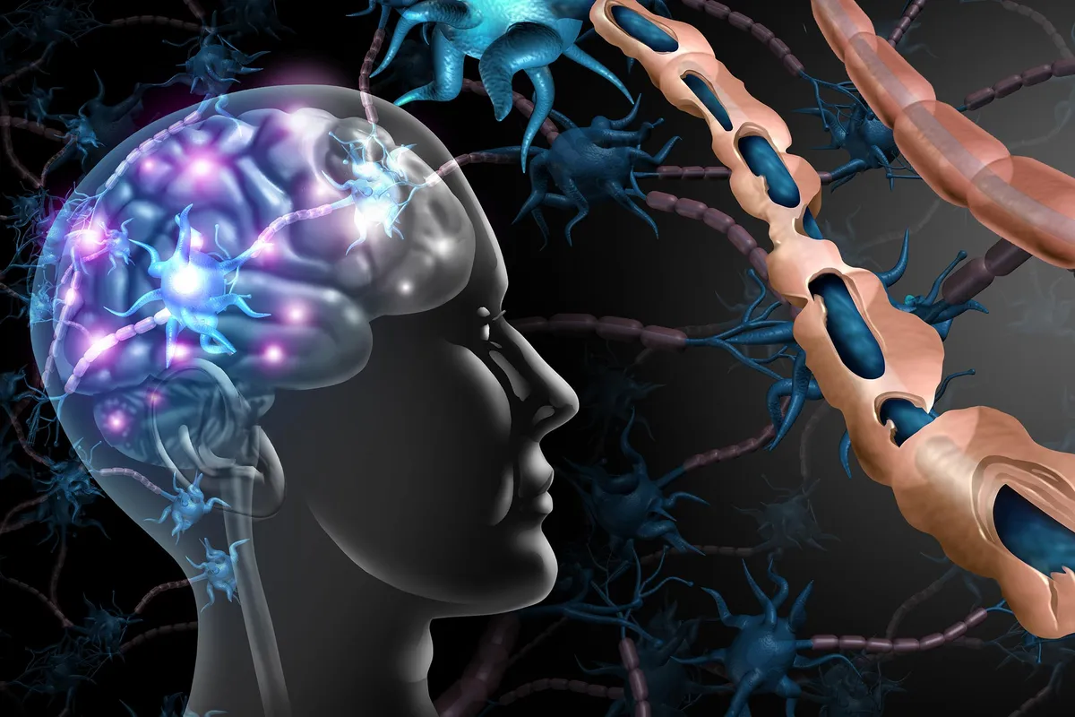 Researchers Compare MS Models to Human Tissue in Search for Better Therapies