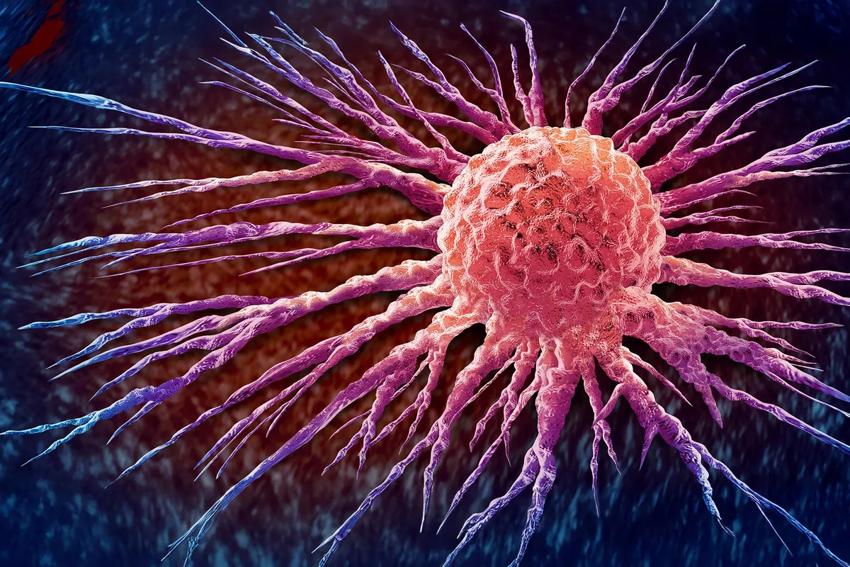 Researchers Uncover a Promising New Way To Stop Prostate Cancer From Spreading