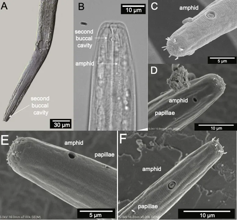 Microscopic images of Diplolaimelloides woaabi, the newly identified nematode species from Great Salt Lake.