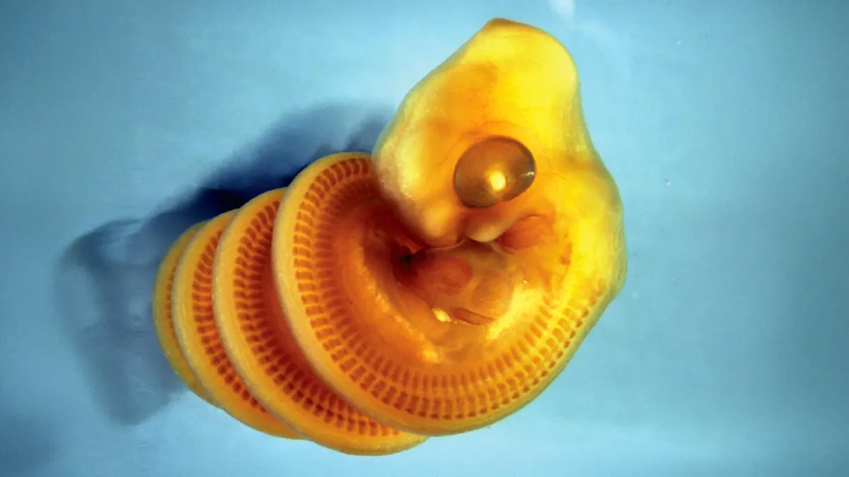 Turns Out, Snake Embryos Spiral Because Their Guts Can't Keep Up