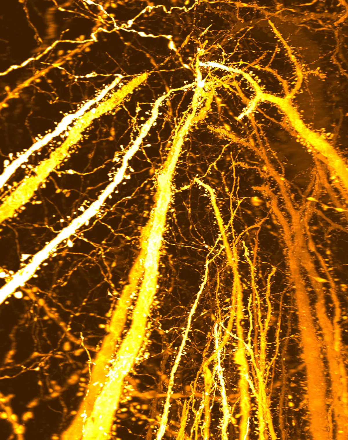 The Teen Brain Builds Synapse Hotspots Scientists Never Saw Before