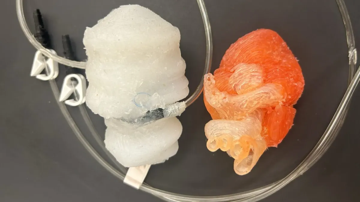 3D-printed beating heart lets surgeons practice before real surgery