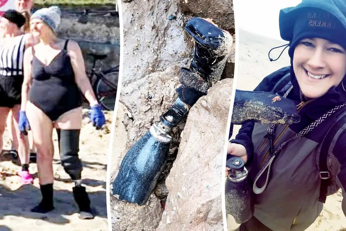 Lost prosthetic leg returns after ten months in the North Sea