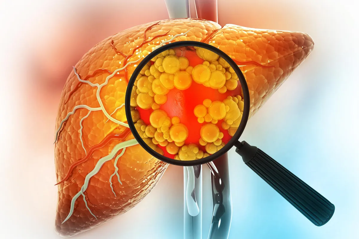 Naturally Occurring Compound May Hold Key to Preventing Liver Disease