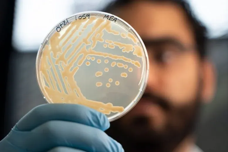 Microbiologist Mohamed Sarhan is examining colonies of yeast taken from a sample of Ötzi’s stomach.