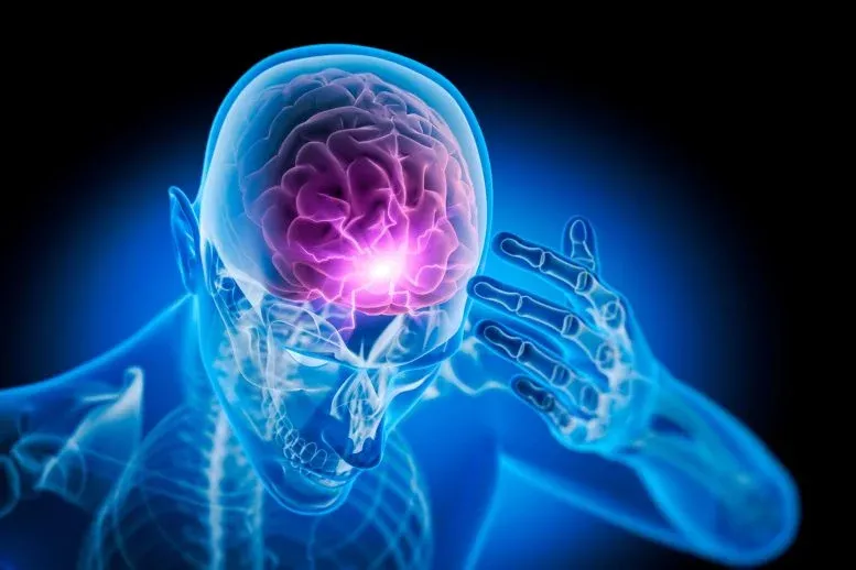 Scientists Uncover New Clues Behind the “Suicide Headache” Mystery