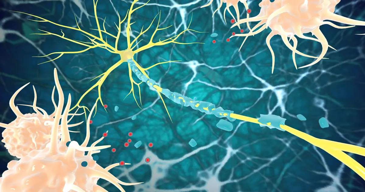 Two drug molecules achieve myelin repair in MS disease models