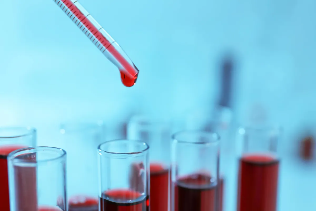 New AI Blood Test Predicts Stroke, Heart Failure, and More up to 15 Years in Advance