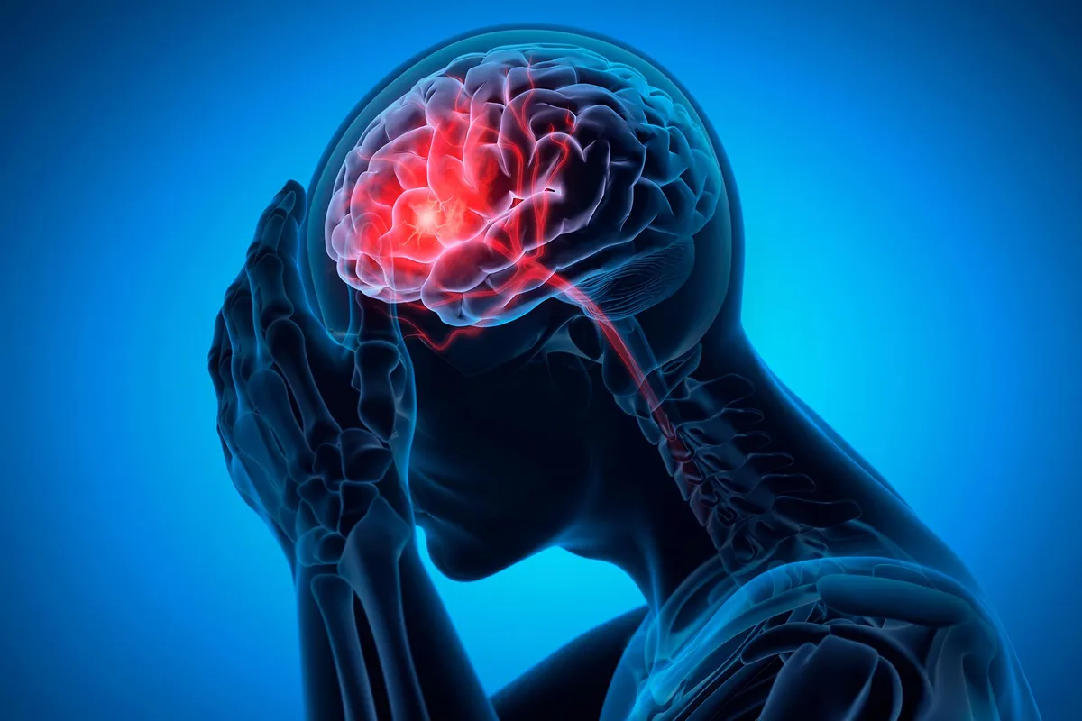 New Anti-Clotting Medication Prevents Strokes Without the Usual Bleeding Risk