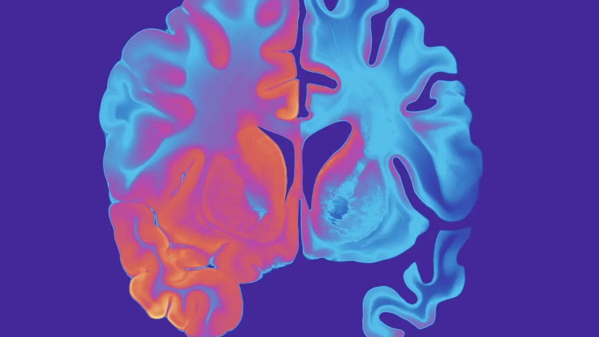 Neuron discovery could explain why some people don't get Alzheimer's