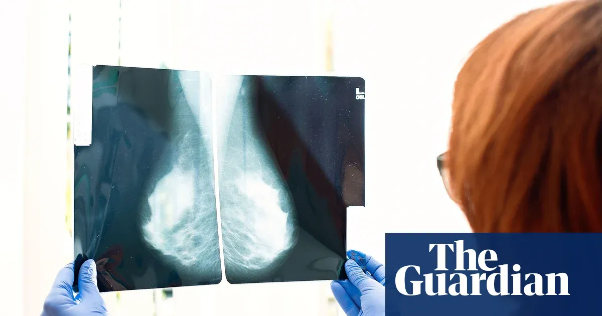 Simple blood test can predict which breast cancer treatment will work best, study finds