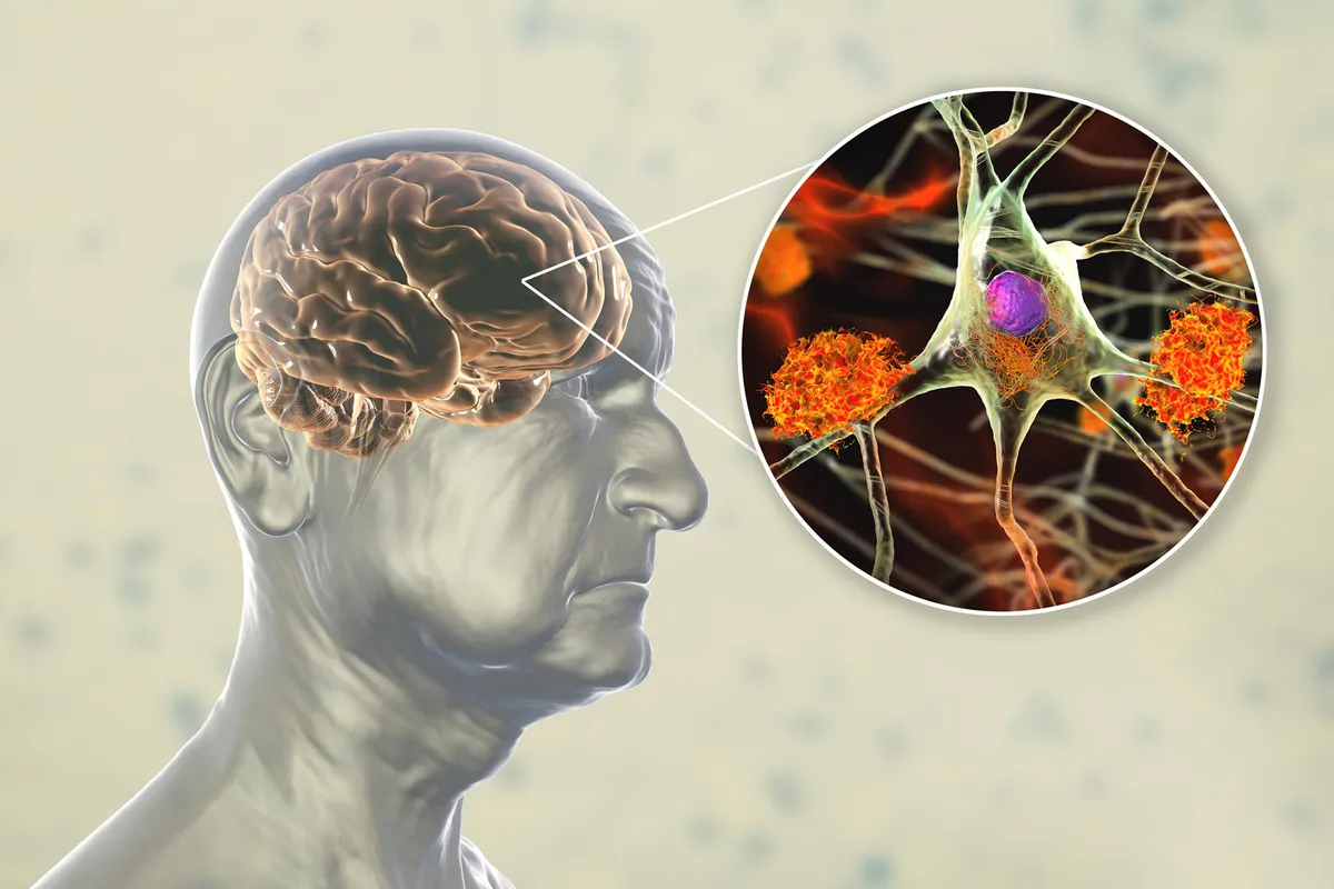 Plant Compounds in Berries, Tea, and Cocoa May Support Healthy Brain Aging