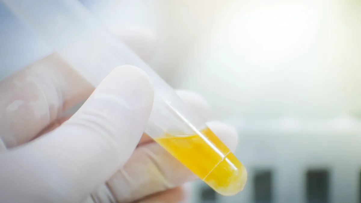 A New At-Home Urine Test Spots Bladder Cancer 92% of the Time